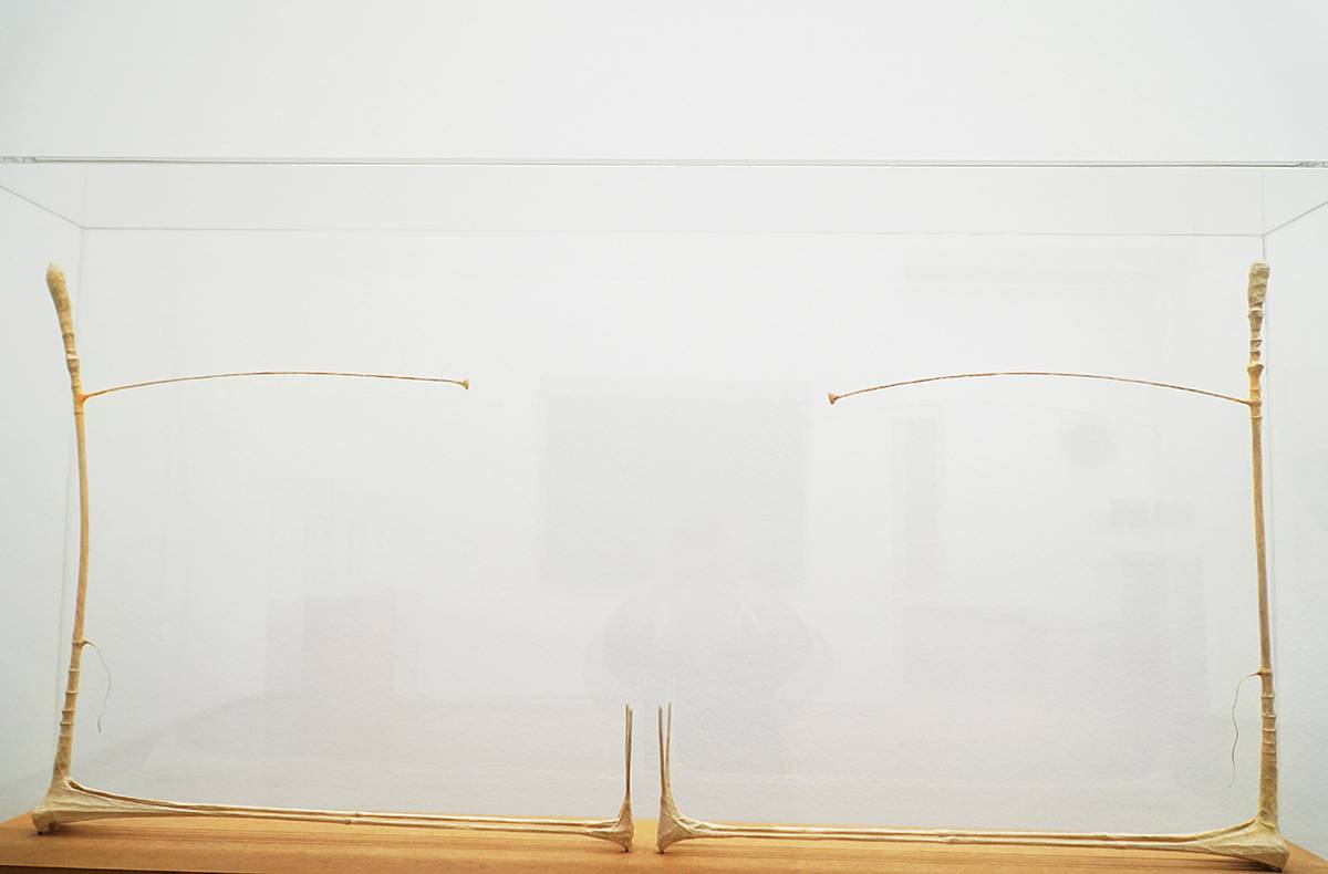 Walter Schmögner: Herzklopfen, 1999